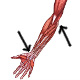 The muscles of the arm, origins and insertions