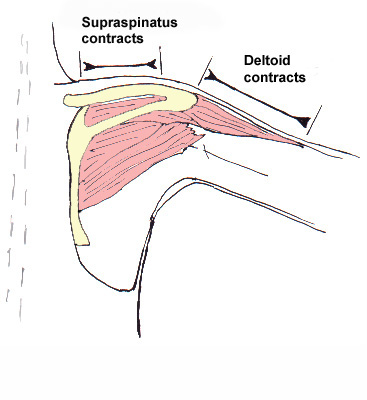 The action of the deltoid - contracted